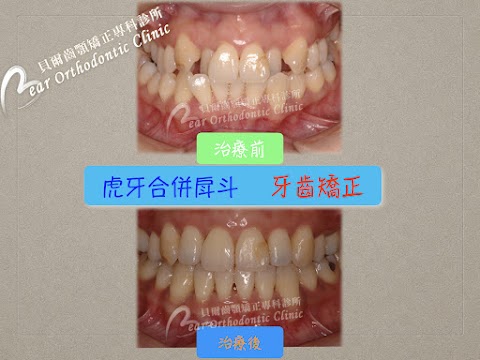 貝爾牙醫